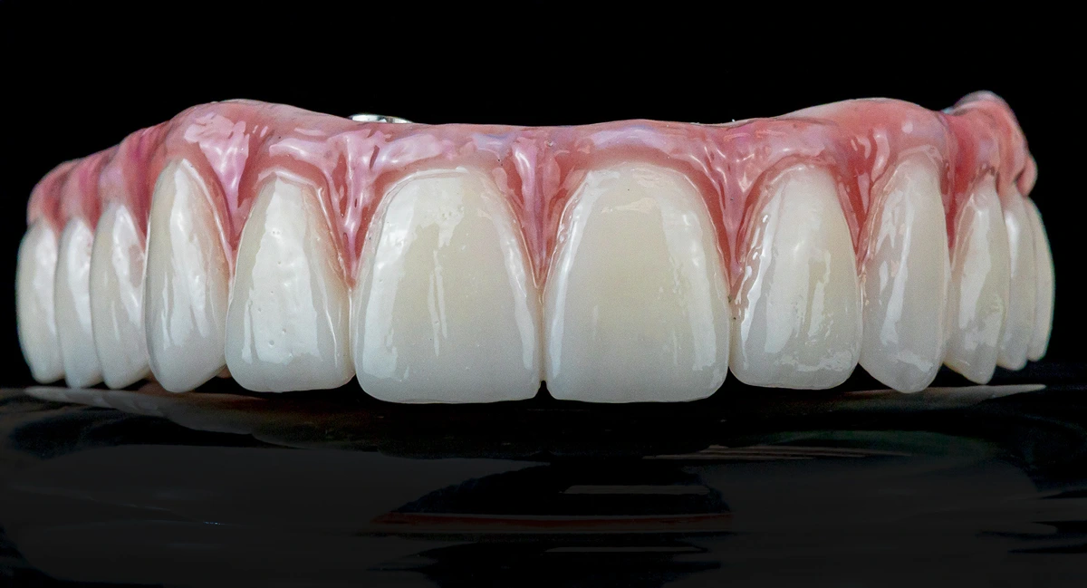 Monolithic Zirconia All-on X | All-on-X | Dani Dental Studio Monolithic Zirconia All-on X | All-on-X | Dani Dental Studio
